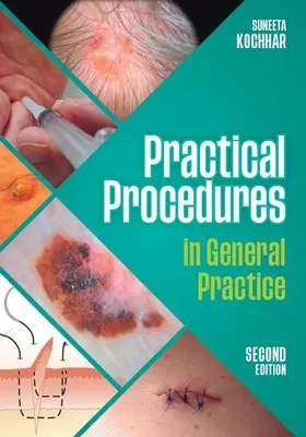 Procedimientos prácticos en medicina general, segunda edición (Kochhar Suneeta (GP in East Sussex)) - Practical Procedures in General Practice, second edition (Kochhar Suneeta (GP in East Sussex))