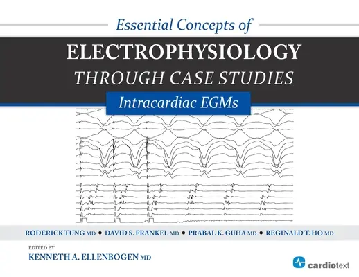 Conceptos Esenciales de Electrofisiología a través de Casos Prácticos: EGMs Intracardíacos EGM intracardíacas - Essential Concepts of Electrophysiology Through Case Studies: Intracardiac EGMs: Intracardiac EGMs