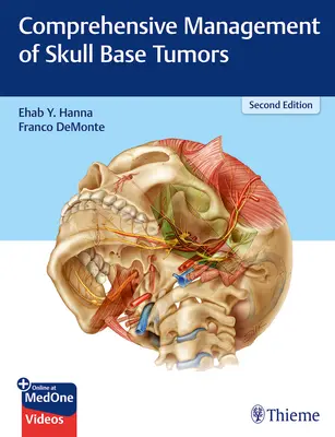 Tratamiento integral de los tumores de la base del cráneo - Comprehensive Management of Skull Base Tumors