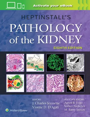 Patología renal de Heptinstall - Heptinstall's Pathology of the Kidney