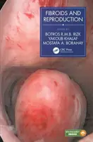 Fibromas y reproducción - Fibroids and Reproduction