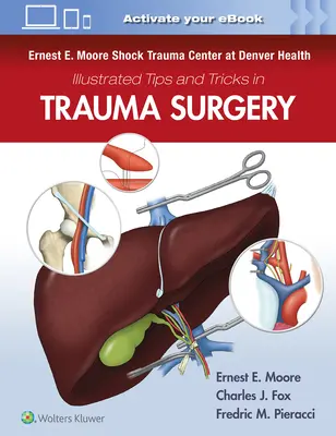 Ernest E. Moore Shock Trauma Center de Denver Health Trucos y consejos ilustrados en cirugía traumatológica - Ernest E. Moore Shock Trauma Center at Denver Health Illustrated Tips and Tricks in Trauma Surgery