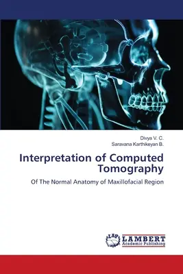 Interpretación de la Tomografía Computarizada - Interpretation of Computed Tomography