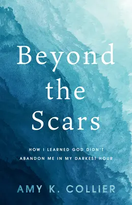 Más allá de las cicatrices: cómo aprendí que Dios no me abandonó en mi hora más oscura - Beyond the Scars: How I Learned God Didn't Abandon Me in My Darkest Hour