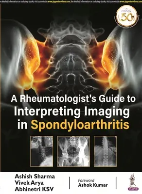 Guía del reumatólogo para la interpretación de imágenes en espondiloartritis - Rheumatologist's Guide to Interpreting Imaging in Spondyloarthritis