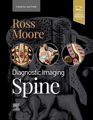 Diagnostic Imaging: Spine (Ross Jeffrey S. (Profesor de Radiología Mayo Clinic College Rochester Minnesota)) - Diagnostic Imaging: Spine (Ross Jeffrey S. (Professor of Radiology Mayo Clinic College Rochester Minnesota))