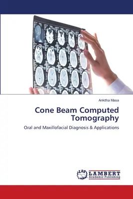 Tomografía computarizada de haz cónico - Cone Beam Computed Tomography