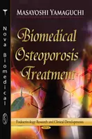 Tratamiento biomédico de la osteoporosis: nuevos avances con factores alimentarios funcionales - Biomedical Osteoporosis Treatment - New Development with Functional Food Factors