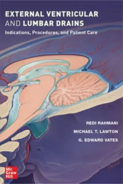 Drenajes ventriculares externos y lumbares: Indicaciones, procedimientos y cuidados del paciente - External Ventricular and Lumbar Drains: Indications, Procedures, and Patient Care