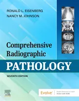 Patología Radiográfica Integral - Comprehensive Radiographic Pathology