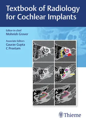 Libro de texto de radiología para implantes cocleares - Textbook of Radiology for Cochlear Implants