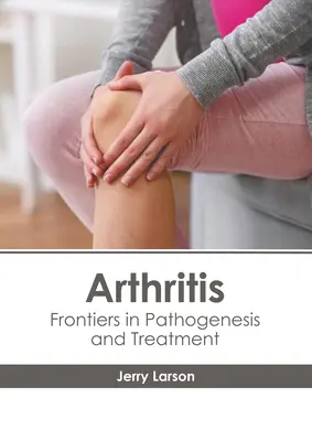 Artritis: Fronteras de la patogénesis y el tratamiento - Arthritis: Frontiers in Pathogenesis and Treatment