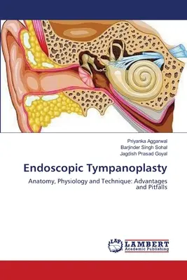Timpanoplastia endoscópica - Endoscopic Tympanoplasty