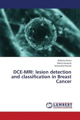 Dce-MRI: Detección y clasificación de lesiones en el cáncer de mama - Dce-MRI: Lesion Detection and Classification in Breast Cancer