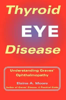 Enfermedad ocular tiroidea: Entender la oftalmopatía de Graves - Thyroid Eye Disease: Understanding Graves' Ophthalmopathy