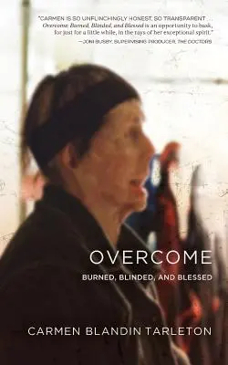 Vencido Quemado, Ciego y Beato - Overcome: Burned, Blinded, and Blessed