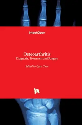 Osteoartritis: Diagnóstico, tratamiento y cirugía - Osteoarthritis: Diagnosis, Treatment and Surgery