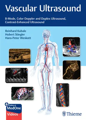 Ultrasonido Vascular: Ultrasonidos en modo B, Doppler color y dúplex, Ultrasonidos con realce de contraste - Vascular Ultrasound: B-Mode, Color Doppler and Duplex Ultrasound, Contrast-Enhanced Ultrasound