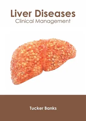 Enfermedades hepáticas: Manejo clínico - Liver Diseases: Clinical Management