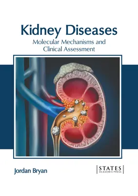 Enfermedades Renales: Mecanismos moleculares y evaluación clínica - Kidney Diseases: Molecular Mechanisms and Clinical Assessment