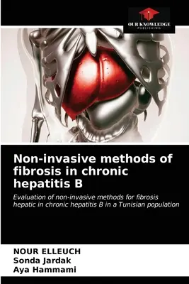 Métodos no invasivos de fibrosis en la hepatitis B crónica - Non-invasive methods of fibrosis in chronic hepatitis B