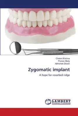 Implante cigomático - Zygomatic implant