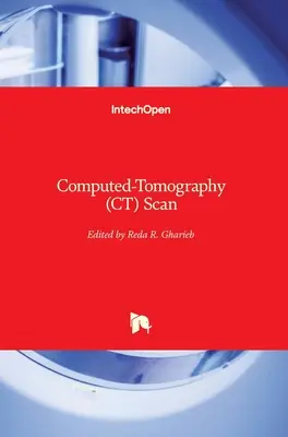 Tomografía computarizada (TC) - Computed-Tomography (CT) Scan