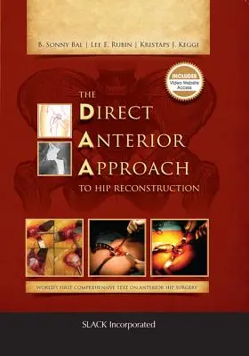 El abordaje anterior directo en la reconstrucción de cadera - The Direct Anterior Approach to Hip Reconstruction