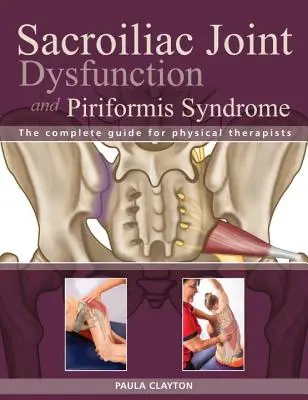 Disfunción de la articulación sacroilíaca y síndrome del piriforme: La Guía Completa para Fisioterapeutas - Sacroiliac Joint Dysfunction and Piriformis Syndrome: The Complete Guide for Physical Therapists