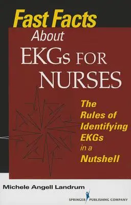 Datos rápidos sobre electrocardiogramas para enfermeras: Las reglas de identificación de los electrocardiogramas en pocas palabras - Fast Facts About EKGs for Nurses: The Rules of Identifying EKGs in a Nutshell