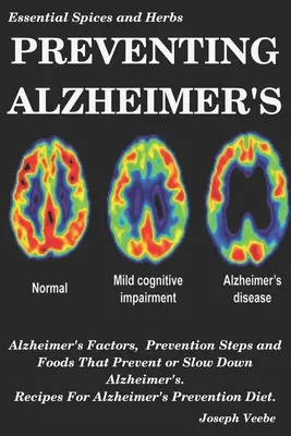 Prevenir el Alzheimer: Factores del Alzheimer, Pasos de Prevención y Alimentos que Previenen o Ralentizan el Alzheimer, Recetas para Prevenir el Alzheimer D - Preventing Alzheimer's: Alzheimer's Factors, Prevention Steps and Foods That Prevent or Slow Alzheimer's, Recipes for Alzheimer's Prevention D