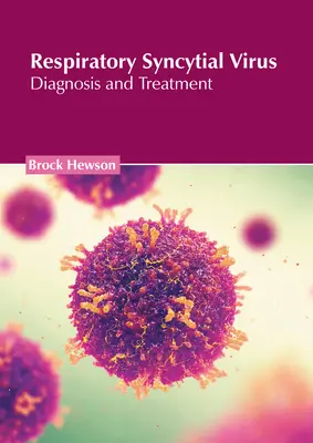 Virus respiratorio sincitial: Diagnóstico y tratamiento - Respiratory Syncytial Virus: Diagnosis and Treatment