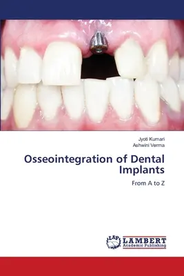 Osteointegración de implantes dentales - Osseointegration of Dental Implants