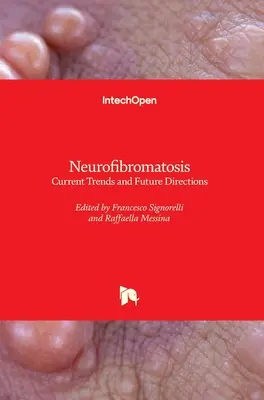 Neurofibromatosis: Tendencias actuales y orientaciones futuras - Neurofibromatosis: Current Trends and Future Directions