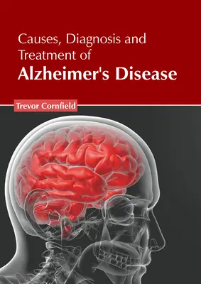 Causas, diagnóstico y tratamiento de la enfermedad de Alzheimer - Causes, Diagnosis and Treatment of Alzheimer's Disease