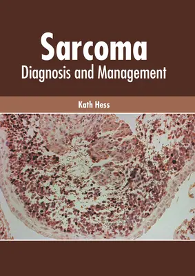 Sarcoma: Diagnóstico y tratamiento - Sarcoma: Diagnosis and Management