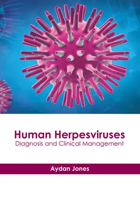 Herpesvirus humano: Diagnóstico y manejo clínico - Human Herpesviruses: Diagnosis and Clinical Management