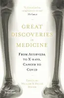 Grandes descubrimientos de la medicina - Del Ayurveda a los rayos X, del cáncer al Covid - Great Discoveries in Medicine - From Ayurveda to X-rays, Cancer to Covid