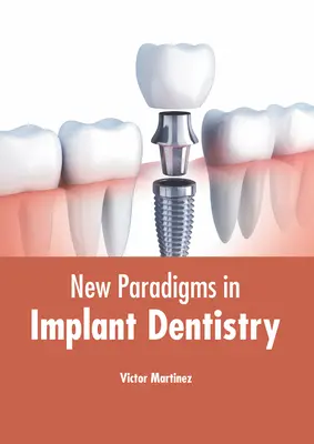 Nuevos paradigmas en implantología - New Paradigms in Implant Dentistry