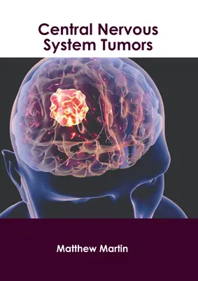 Tumores del sistema nervioso central - Central Nervous System Tumors