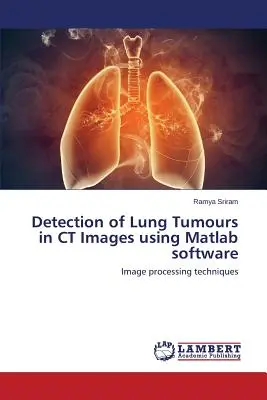 Detección de tumores pulmonares en imágenes de TC mediante software Matlab - Detection of Lung Tumours in CT Images using Matlab software