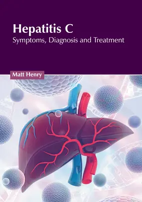 Hepatitis C: Síntomas, diagnóstico y tratamiento - Hepatitis C: Symptoms, Diagnosis and Treatment