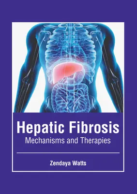 Fibrosis hepática: Mecanismos y terapias - Hepatic Fibrosis: Mechanisms and Therapies