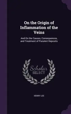 Sobre el origen de la inflamación de las venas: Y De Las Causas, Consecuencias Y Tratamiento De Los Depósitos Purulentos - On the Origin of Inflammation of the Veins: And On the Causes, Consequences, and Treatment of Purulent Deposits