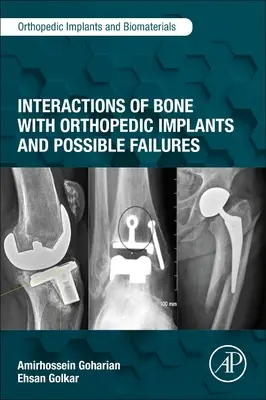 Interacciones del hueso con implantes ortopédicos y posibles fallos - Interactions of Bone with Orthopedic Implants and Possible Failures
