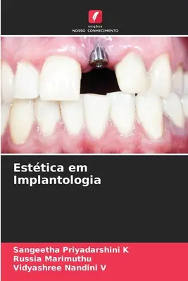 Esttica en Implantologa - Esttica em Implantologia