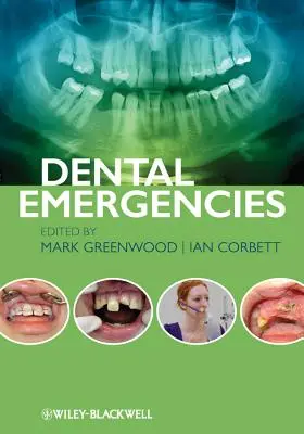 Urgencias Odontológicas - Dental Emergencies