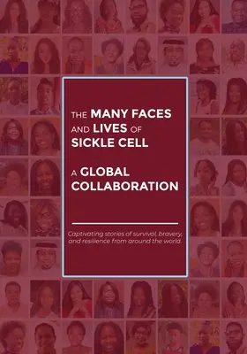 Las muchas caras y vidas de la anemia falciforme: una colaboración mundial - The Many Faces and Lives of Sickle Cell - A Global Collaboration