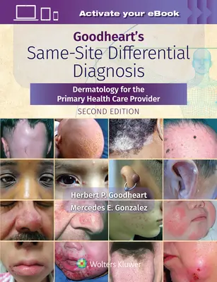 Goodheart's Same-Site Differential Diagnosis: Dermatología para el médico de atención primaria - Goodheart's Same-Site Differential Diagnosis: Dermatology for the Primary Health Care Provider