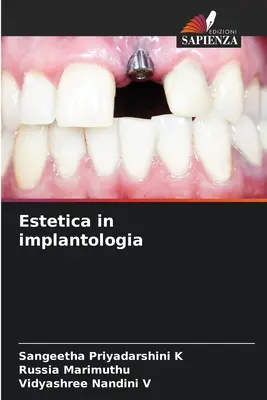 Estética en implantología - Estetica in implantologia